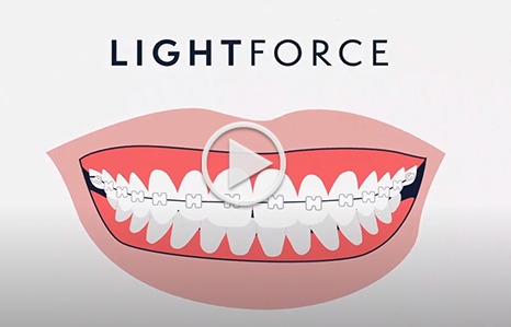 Lightforce Anchored Orthodontics in Minnetonka, MN